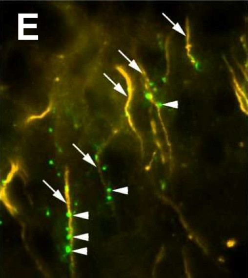 A gátlósejt axonterminálisok (zöld) más idegsejtek axon eredésén (sárga) alkotnak kapcsolatokat