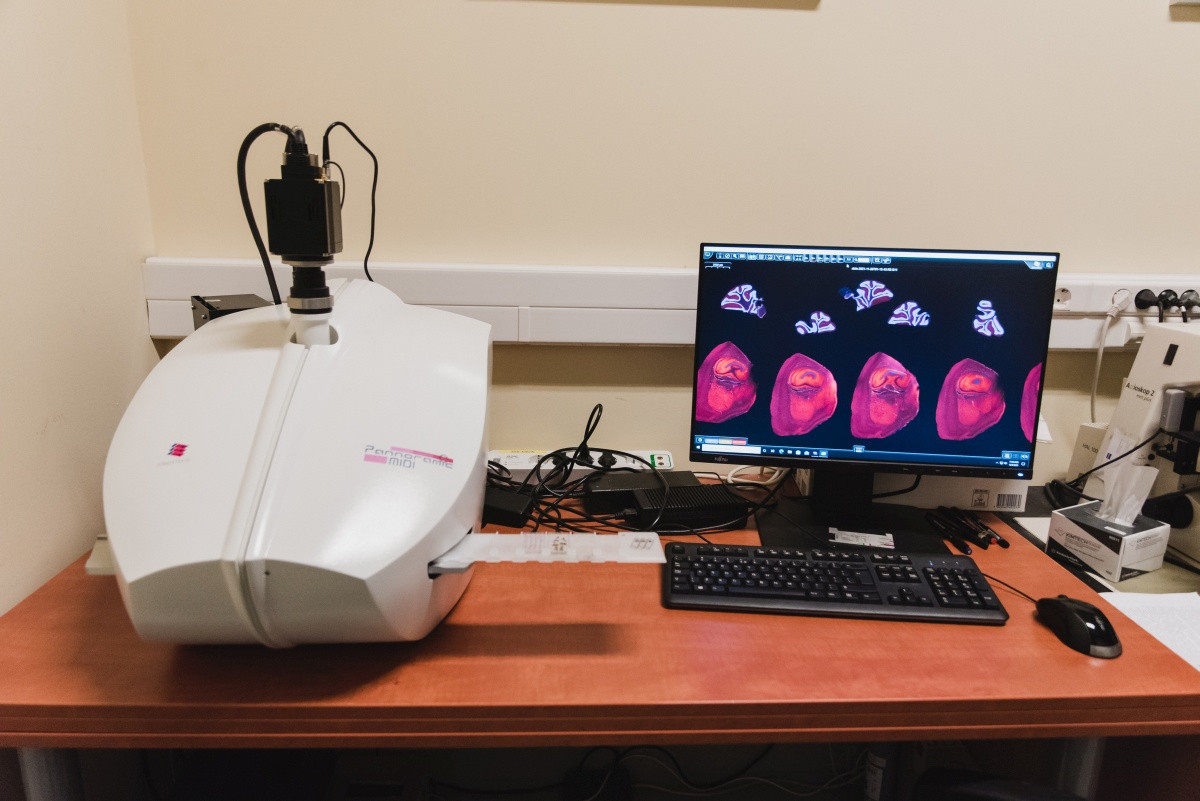 Az agyról készült sorozatmetszeteket fényképezi le automatikusan Az agyról készült sorozatmetszeteket fényképezi le automatikusan