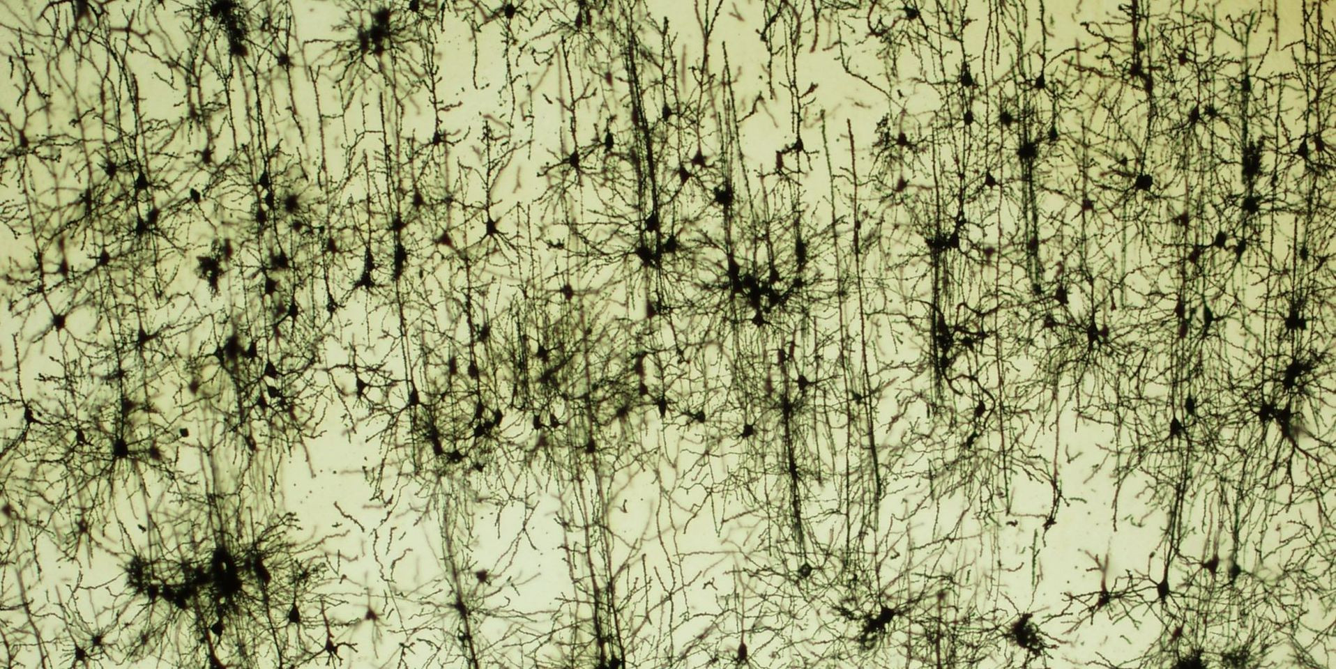 Véletelen szerűen kirajzol egyedi sejteket