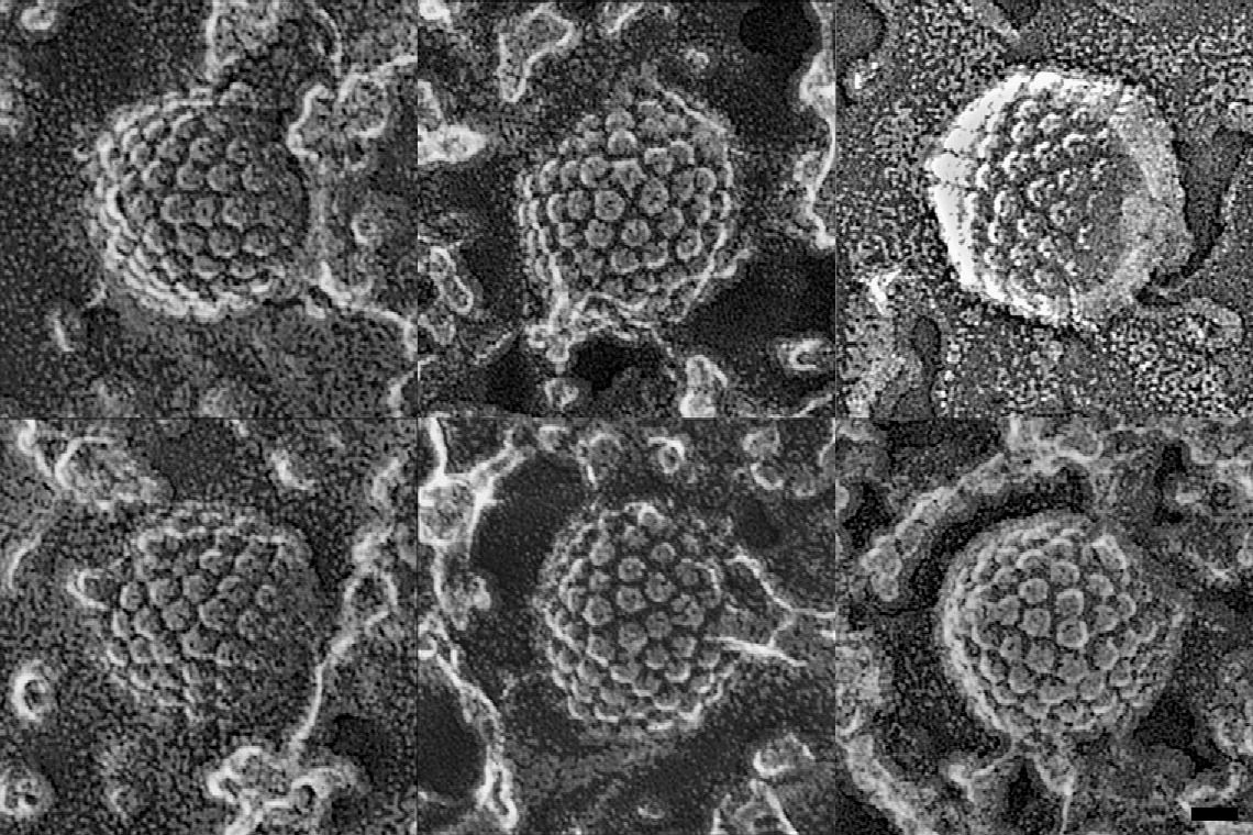 Herpesz víros fagyasztva szárított elektronmikroszkópos képe. Ezzel a technikával jól kiemelhető a kapszidok 3D szerkezet. A kapsidot alkotó fehérje golyócskák ikozaéder alakba kapcsolódva alkotják a vírus borítóját, melynek belsejében utazik annak DNS-e néhány,  aműködés megkezdéséhez szükséges fehérje.