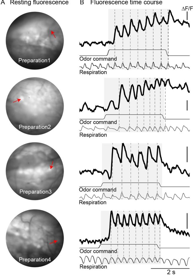 Az ArcLight első generációs feszültség szenzor még csak nagy mennyiségű idegsejt lassú válaszát volt képes érzékelni. Az elvezetés a szaglóhagyma eltérő szagokra adott válaszának légzéshez hangolt lassú válaszát mutatja be. Rossz mind a tér mind az időbeli felbontás.