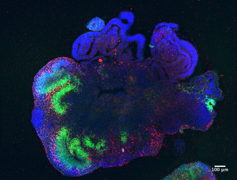 Egy cerebral organoid: mesterségesen növesztett sejtcsoportosulás, melynek felépítése hasonló az agykérgéhez.