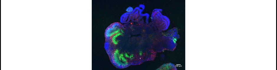 Organoidok: a jó, a rossz és a gyönyörű
