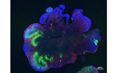 Organoidok: a jó, a rossz és a gyönyörű