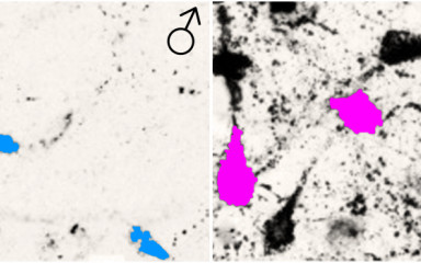Morphometry, image analysis