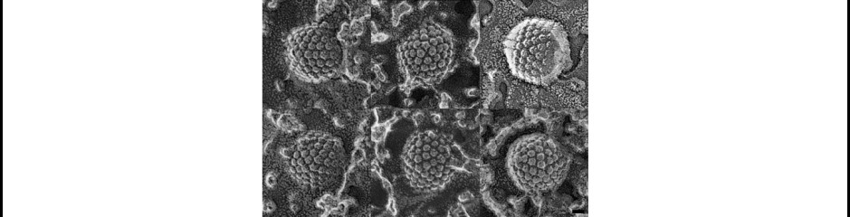 Herpesz-állás: avagy miért bújnak a vírusok az idegsejtekbe?