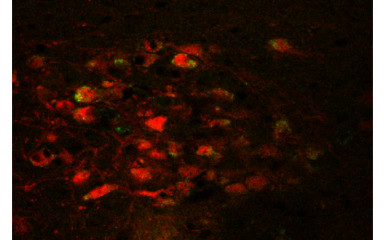 A stressz neurobiológiája