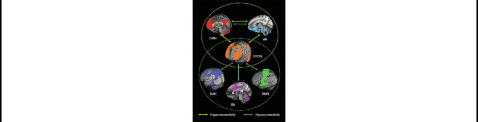 Az agy funkcionálisan azonosított hálózatai I: Miért vált az agy pillanatról-pillanatra