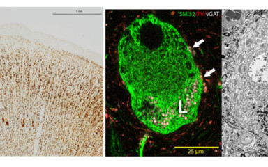 Immunohisztokémia