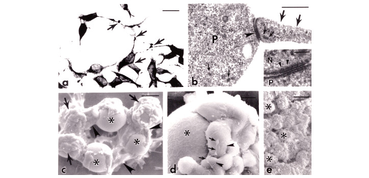 Immortalized GnRH neurons diakép