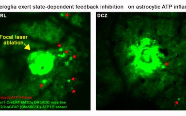 Everything you want to know and see about microglia...