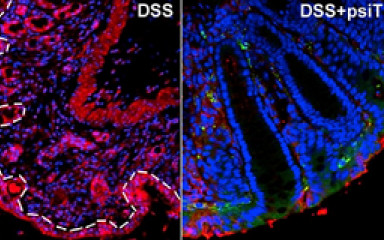 Development of therapeutic bacteria