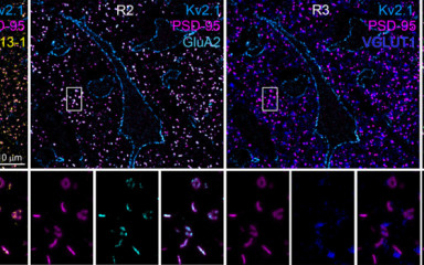 A small step closer to understanding schizophrenia