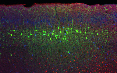 The reward system and the medial prefrontal cortex