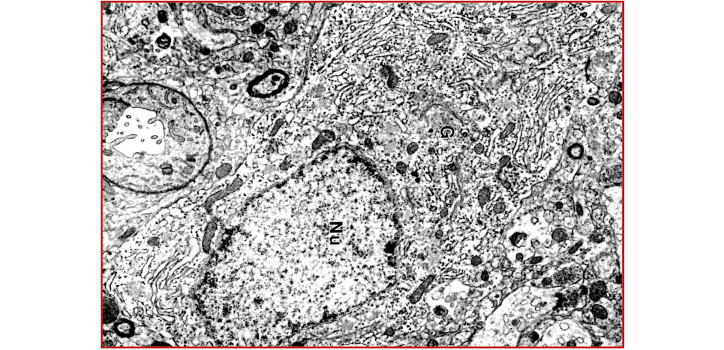 Corticotropin-releasing hormone-t szintetizáló idegsejt finomszerkezete diakép