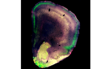 Elfogadták Nagy-Pál Petra első elsőszerzős közleményét a Journal of Neuroscence-ben