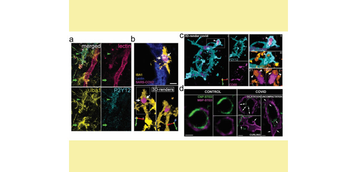 COVID and microglia diakép