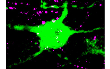 Interaction between metabolic and fertility circuitries