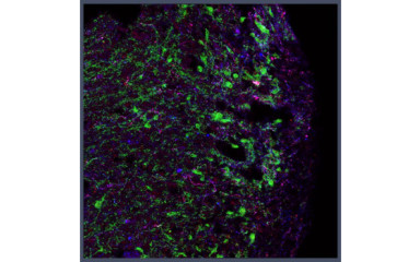 Ageing-related changes of the hypothalamic neurocircuitry regulating human reproduction