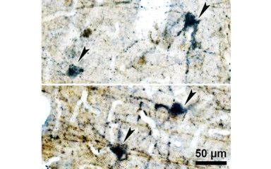 How the Brain Links Fear to Negative Memories