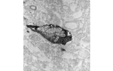 Electron Microscopy