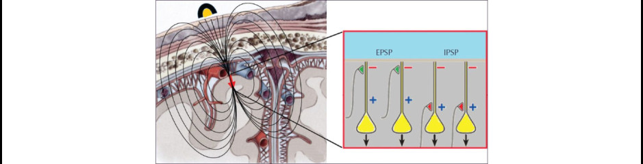Mit is hallunk pontosan az elektródáinkkal? Az EEG jelek kialakulásának ördögi részletei