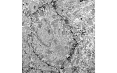 Light and electron microscopic immunohistochemistry