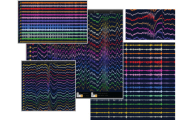 Population recording with high density electrode arrays in head-fixed mice