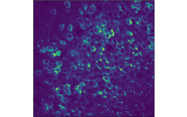 Imaging