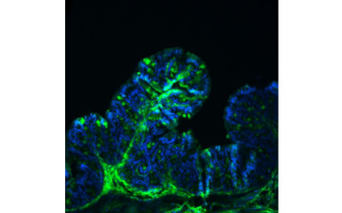 Function and role of the gut microbiome-brain axis