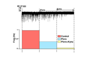 Slice electrophysiology