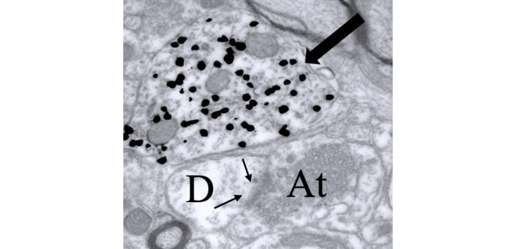 Silver intensified colloidal gold-labeled GnRH dendrite diakép