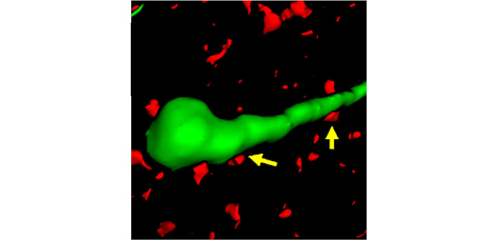 Cholinergic axons contacting GnRH neuron diakép