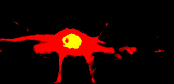 Estrogen receptor beta expression in cortical GABAergic neuron diakép