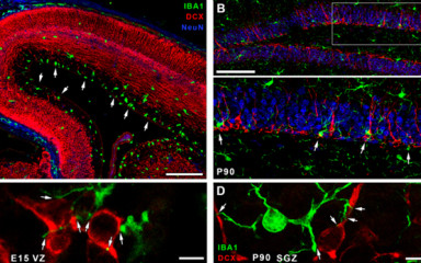 Micromanipulation: somatic microglia-neuron connections in the developing brain