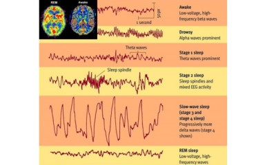 Az EEG és a viselkedés összefüggése I.