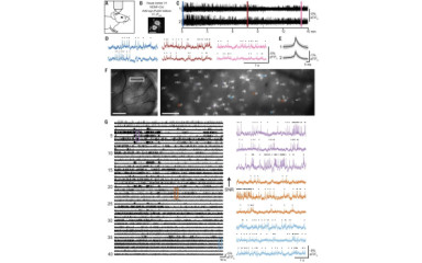 VIP idegsejt mozi: feszültség érzékeny szenzorokkal láthatók az idegsejteken szaladgáló jelek