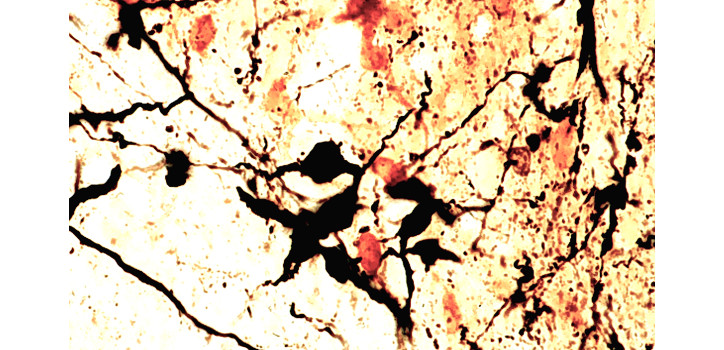 Dopaminergic innervation of corticotropin-releasing hormone-synthesizing neurons diakép
