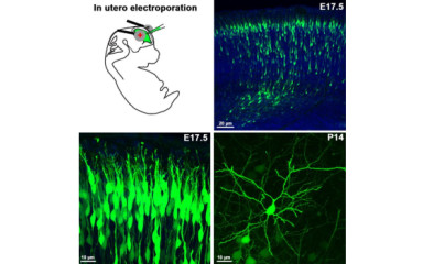 In utero elektroporáció