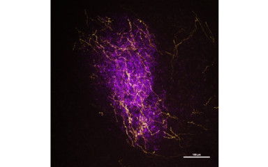 A novel midbrain-extended amygdala pathway controls defensive behavior