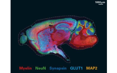 Újkeletű molekuláris-genetikai mérő módszerek: Ezt most mind mutasd meg, de gyorsan!