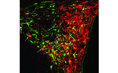 Neuronal tract-tracing methods