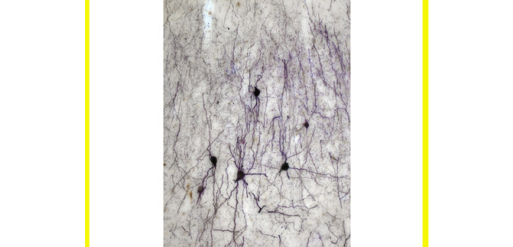 Another step towards understanding the human hippocampus and its diseases diakép