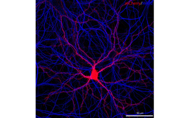 Immuncitokémia és élősejtes képalkotás
