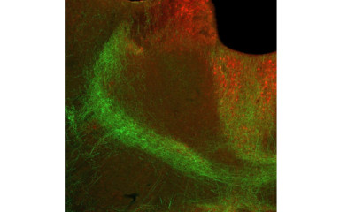 Thalamus and Stress