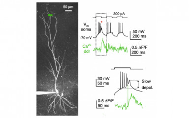 Patch-clamp electrophysiology combined with in vitro two-photon imaging