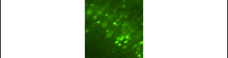 Microproject: Mindenre (fluoreszcens) fény derül.