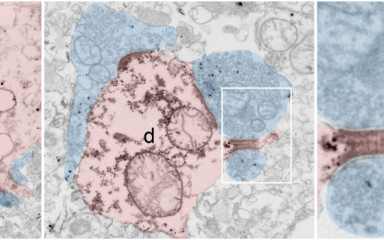 Electron microscopy
