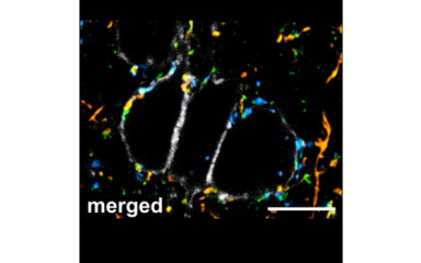 Microcircuit organization of the perisomatic inhibition in the medial prefrontal cortex