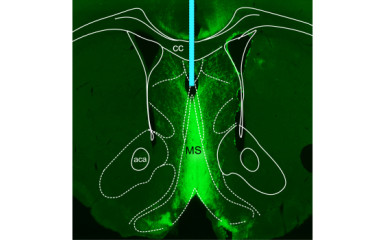 Selective manipulations of neurons by optogenetics